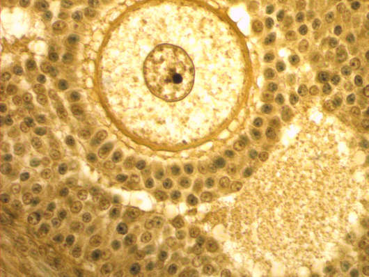 Follicle with central ovum in the ovary